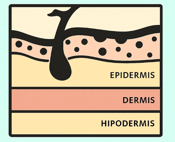 Melasma: causas y tratamientos más efectivos para las manchas de la piel